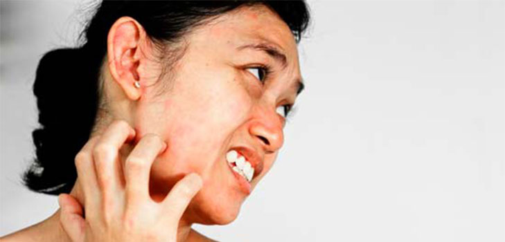 Подкожный клещ на лице − причина заболевания и эффективное лечение