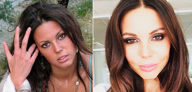 Что Оксана Самойлова (жена Джигана) изменила во внешности: фото до и после пластики