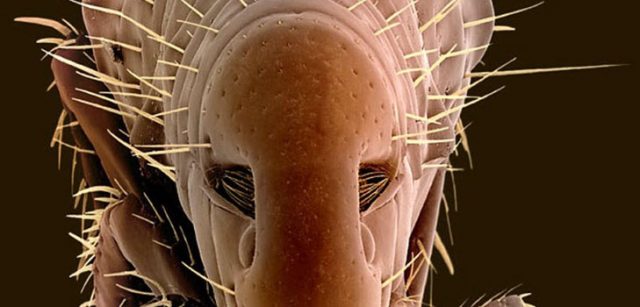 Блохи у человека – будьте бдительны!