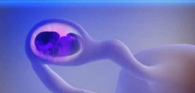 Как определить внематочную беременность