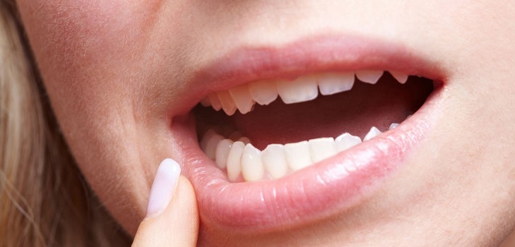 Почему чешутся зубы у взрослого