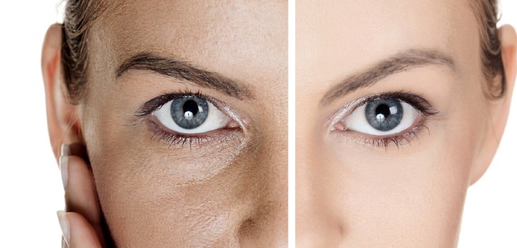 Как улучшить цвет лица и состояние кожи
