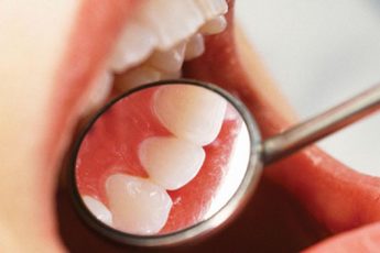 Благоприятные дни для лечения зубов в феврале 2018 для всех знаков зодиака