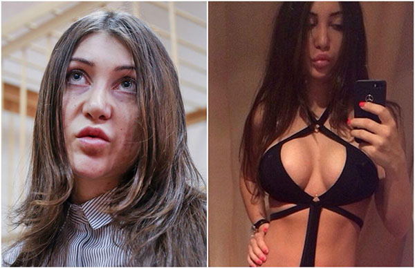 Чья дочь Мара Багдасарян. Фото до и после пластики