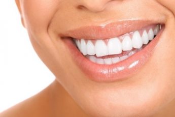 красивые зубы